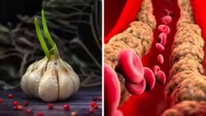 सुबह लहसुन खाना: क्या वाकई घटता है कोलेस्ट्रॉल? जानिए पूरी सच्चाई