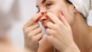 पिंपल्स फोड़ना पड़ सकता है भारी, चेहरा खराब होने और इन्फेक्शन का बढ़ता है खतरा