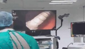 मौत के मुंह से लौटी 4 साल की अमायरा: आंत में फंसी थी 3 सेंटीमीटर लंबी कील, डॉक्टरों ने किया करिश्मा