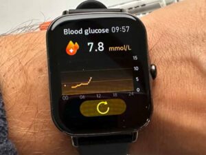 क्या स्मार्टवॉच से पता चलेगा डायबिटीज का खतरा? दुबई में शुरू हुआ खास टेक ट्रायल