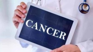 कैंसर इलाज के लिए अब दिल्ली-मुंबई पर आश्रित नहीं यूपी